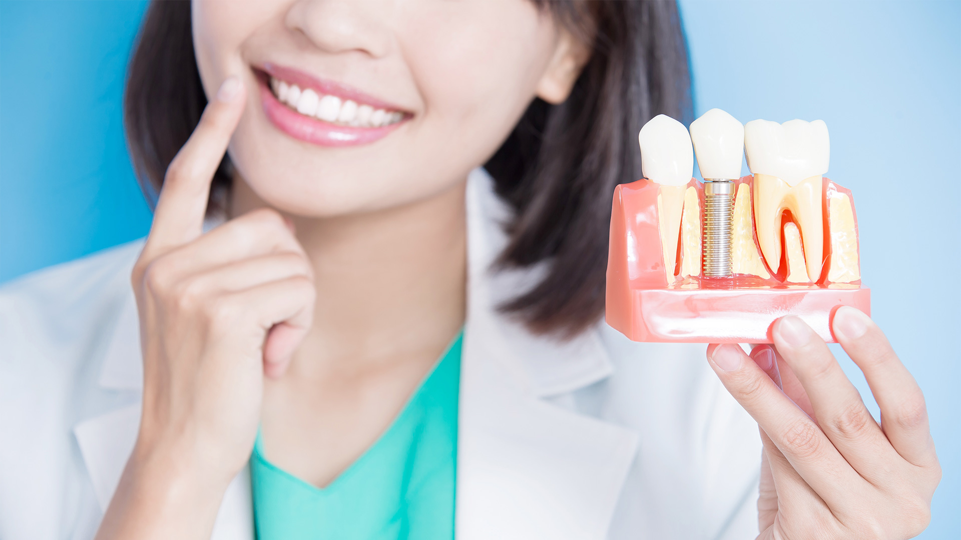 Что нужно знать про зубные импланты